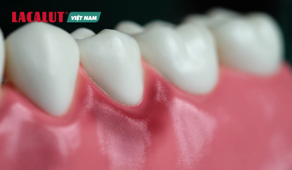 rang-e-buot-chay-mau-bao-hieu-viem-nuou răng ê buốt chảy máu báo hiệu viêm nướu