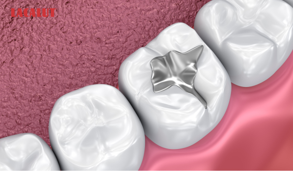 trám răng khắc phục tình trạng răng bị ê buốt khi uống nước