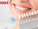 tìm hiểu kỹ về chất liệu răng sứ